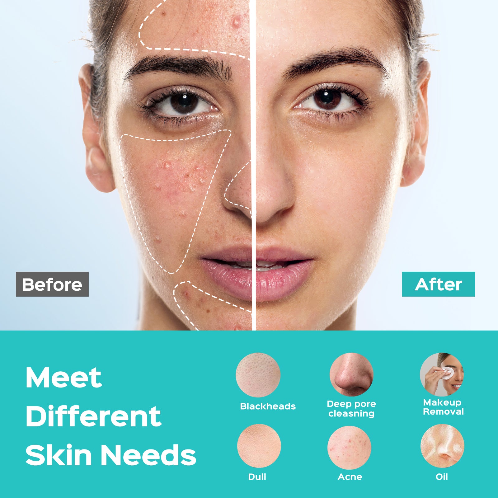 coslus-skin-care-fbs01x-gesichtsreinigungsb-rste-blau image 3