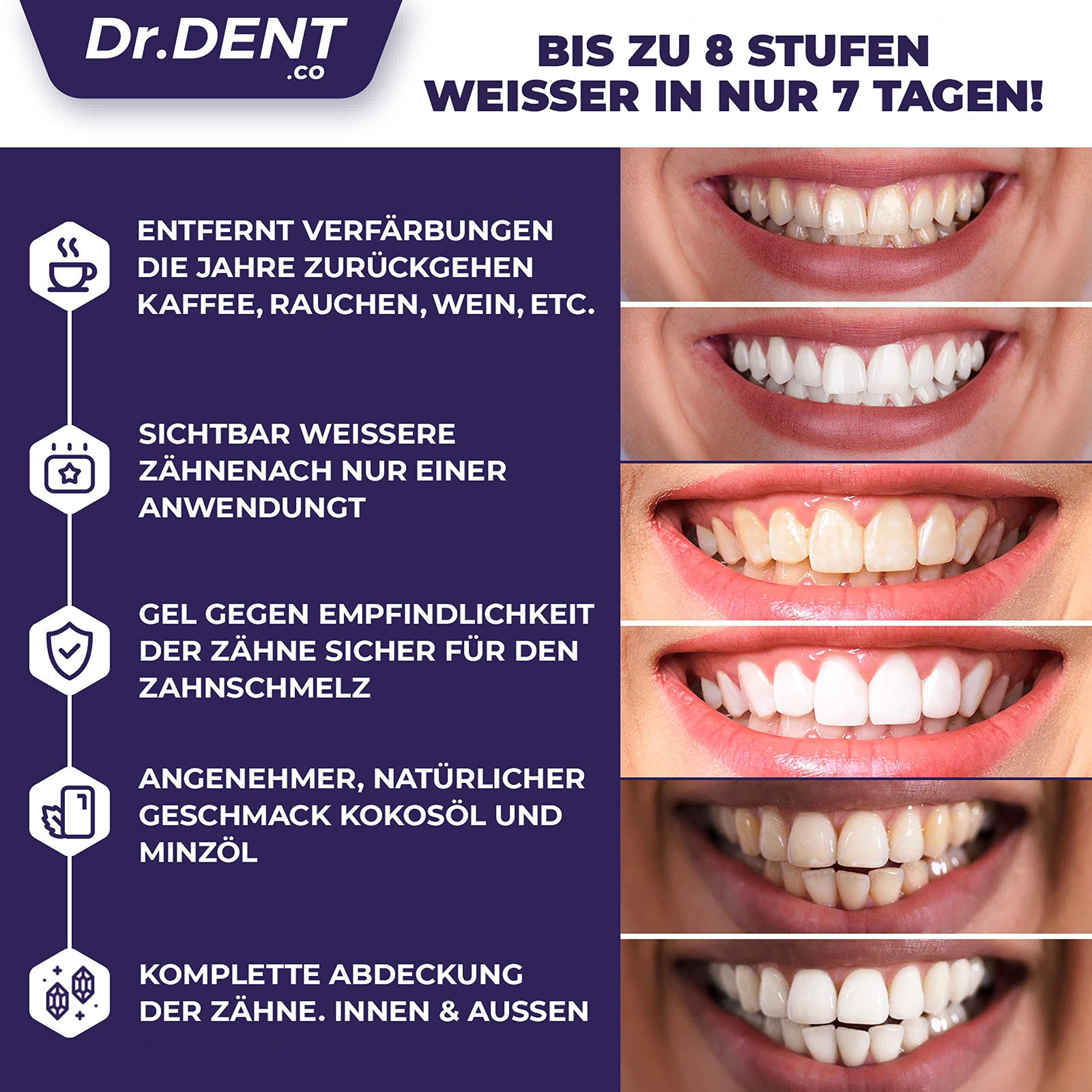 drdent-teeth-whitening-strips-peroxidfrei-40-streifen image 5