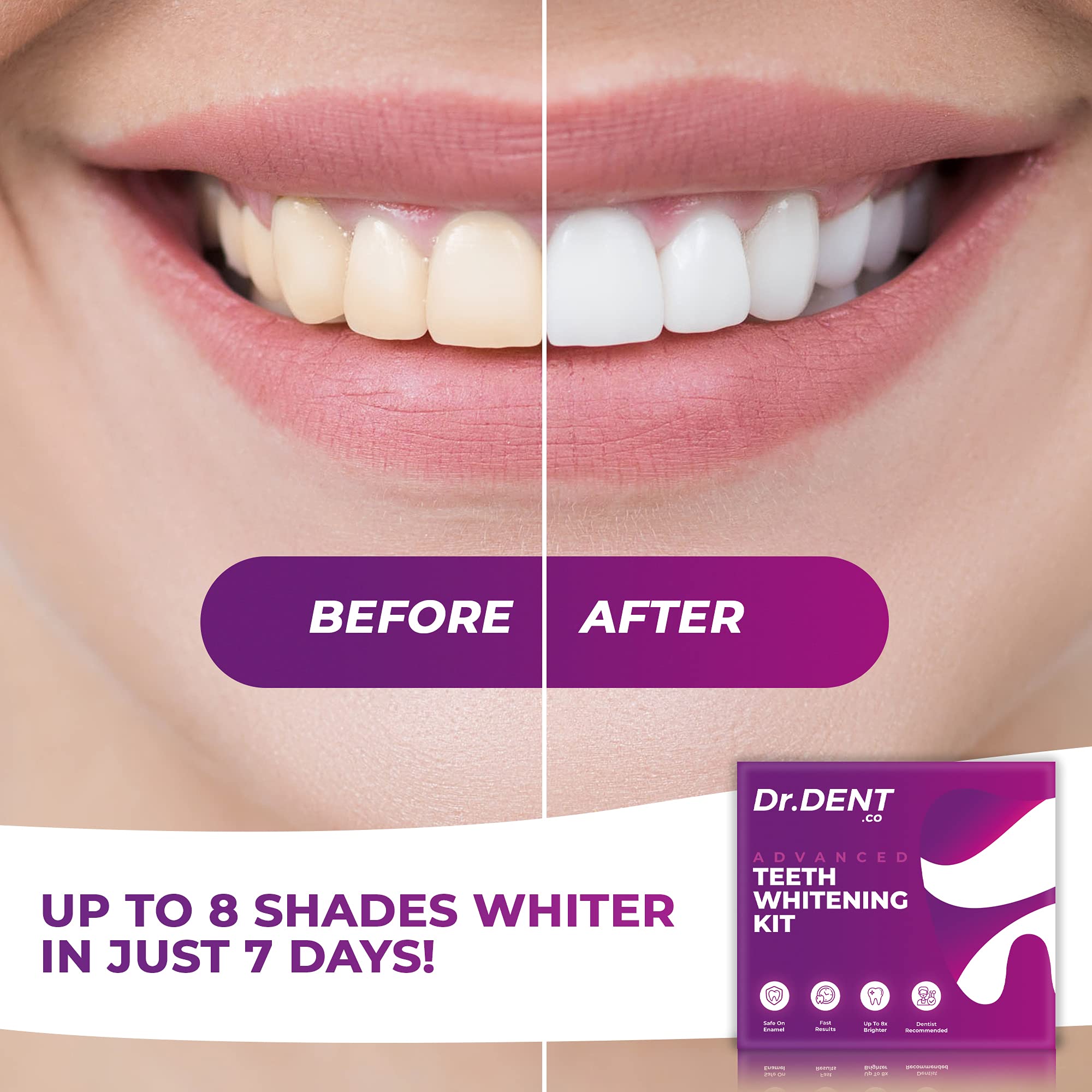 drdent-led-teeth-whitening-kit-zahnwei-set-3-gels-led image 3