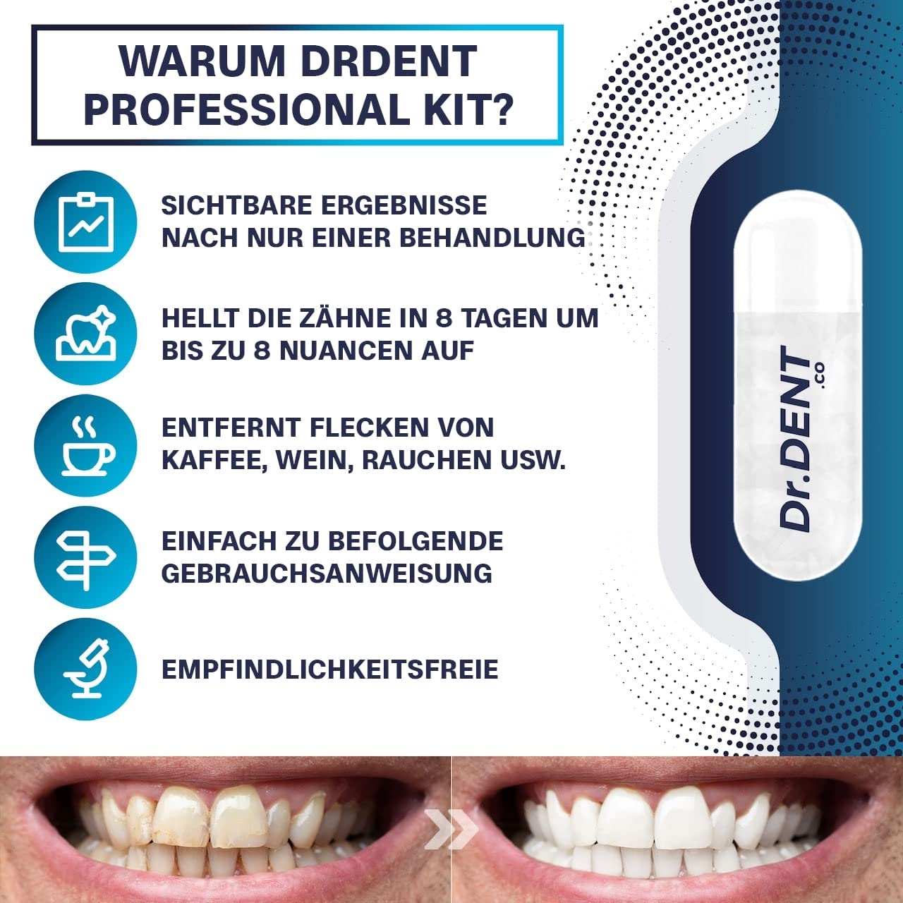 drdent-led-teeth-whitening-kit-zahnaufhellung-8-kapseln-peroxidfrei image 4